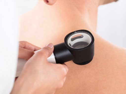 Skin Cancer Procedures